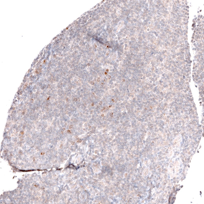 Staining of human tonsil shows mainly very weak positivity in non-germinal center cells.