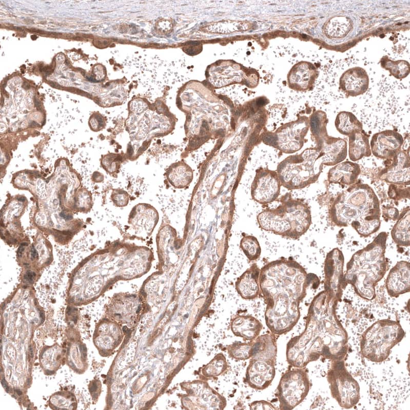 Staining of human placenta shows moderate cytoplasmic and membranous positivity in trophoblastic cells.