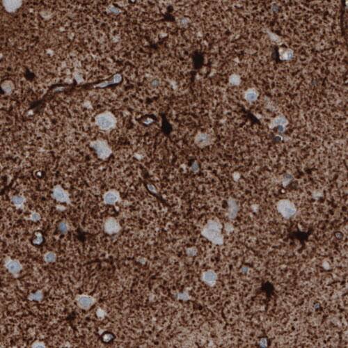 Staining of human cerebral cortex shows strong immunoreactivity in astrocytes.