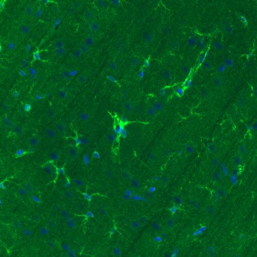 Staining of rat cerebral cortex shows immunoreactivity in a subset of astrocytes.