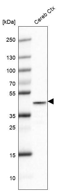 Analysis in mouse cerebral cortex tissue.