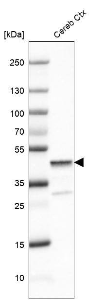 Analysis in human cerebral cortex tissue.