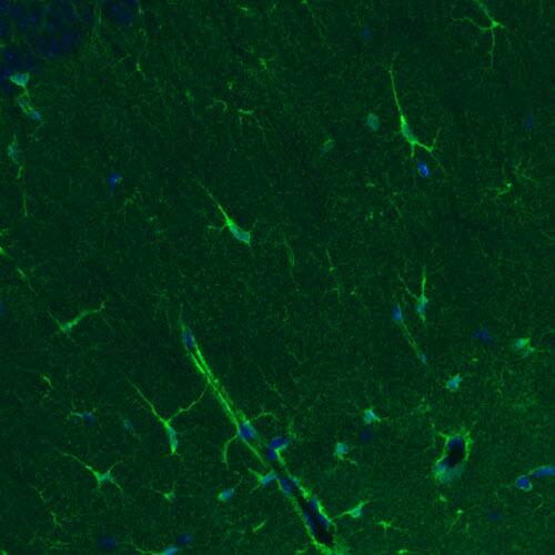 Staining of mouse hippocampal formation shows positivity in a subset of astrocytes.