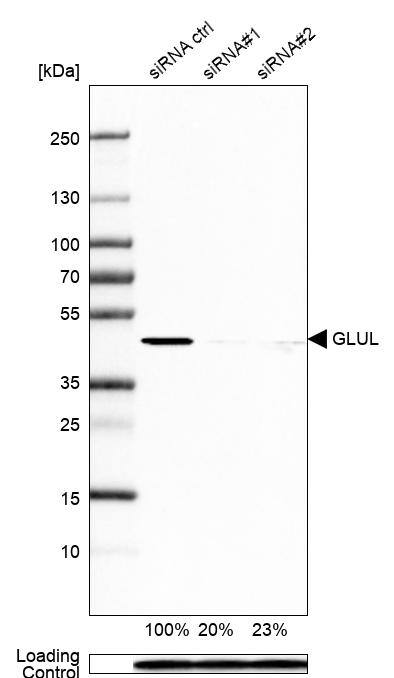 Analysis in HEK293 cells transfected with control siRNA, target specific siRNA probe #1 and #2, using Anti-Glutamine Synthetase antibody. Remaining relative intensity is presented. Loading control: Anti-PPIB.