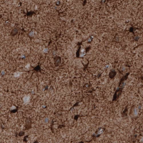 Staining of human cerebral cortex shows strong immunoreactivity in astrocytes.