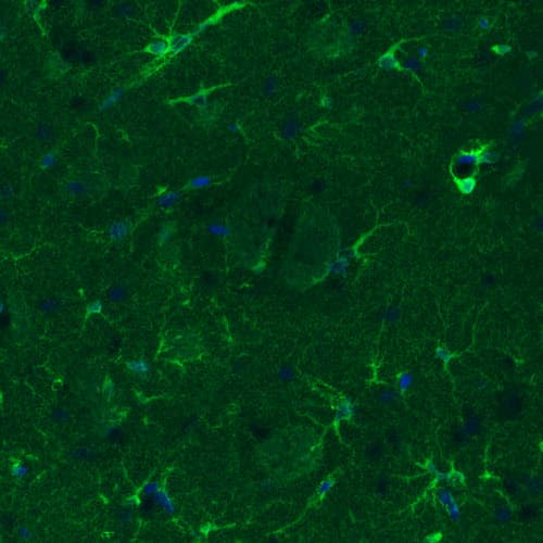 Staining of rat striatum shows moderate immunoreactivity in a subset of astrocytes.