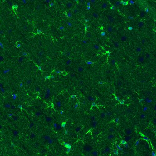 Staining of rat cerebral cortex shows positivity in a subset of astrocytes.