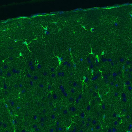 Staining of rat cerebral cortex shows positivity in a subset of astrocytes.