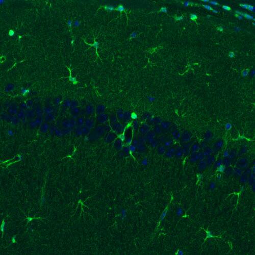 Staining of mouse hippocampal formation shows positivity in a subset of astrocytes.