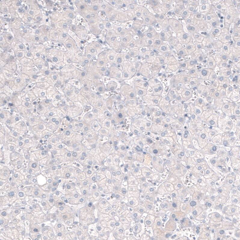 Staining of human liver shows no positivity in hepatocytes as expected.