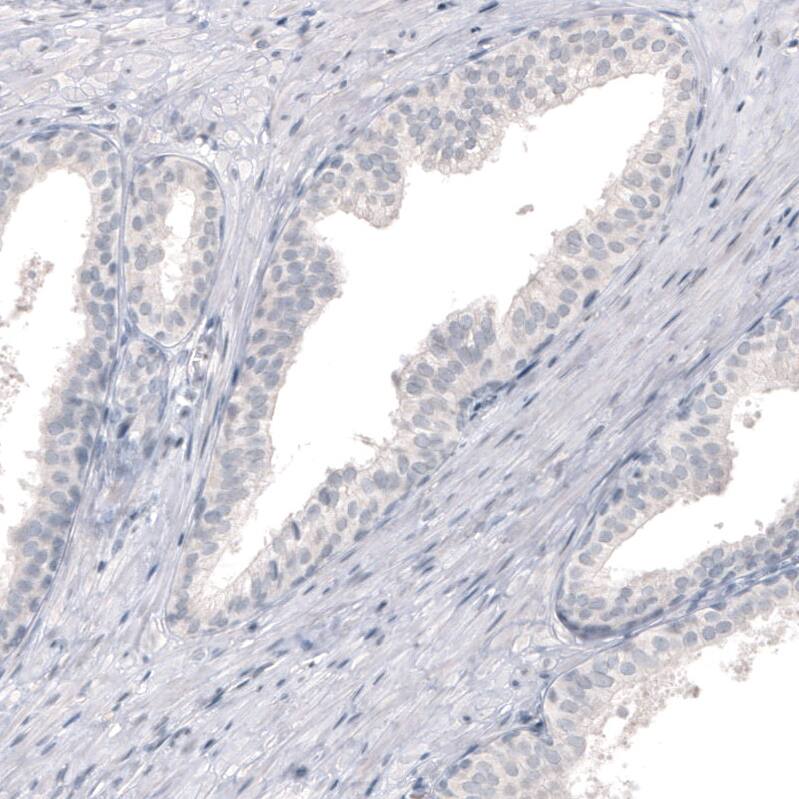 Staining of human prostate shows no positivity in glandular cells as expected.