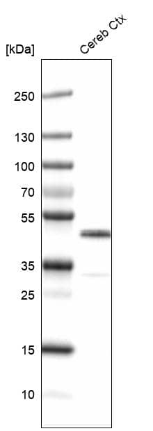 Analysis in mouse cerebral cortex tissue.