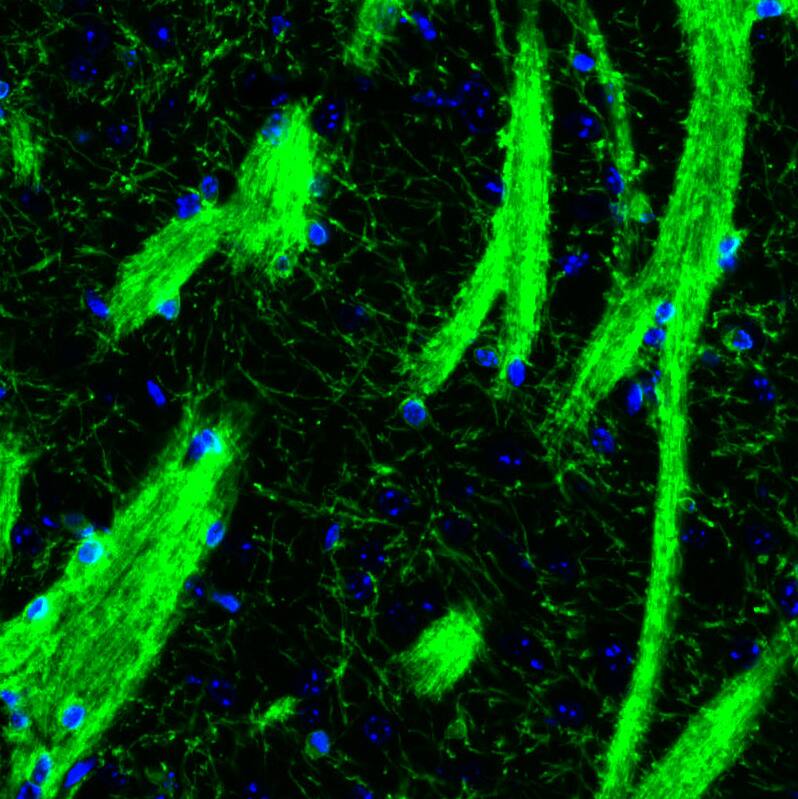 Staining of mouse basal forebrain shows strong positivity in oligodendrocytes and myelinated fiber tracts in the striatum.