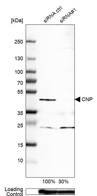 Analysis in A-549 cells transfected with control siRNA, target specific siRNA probe #1, using Anti-CNPase antibody. Remaining relative intensity is presented. Loading control: Anti-GAPDH.