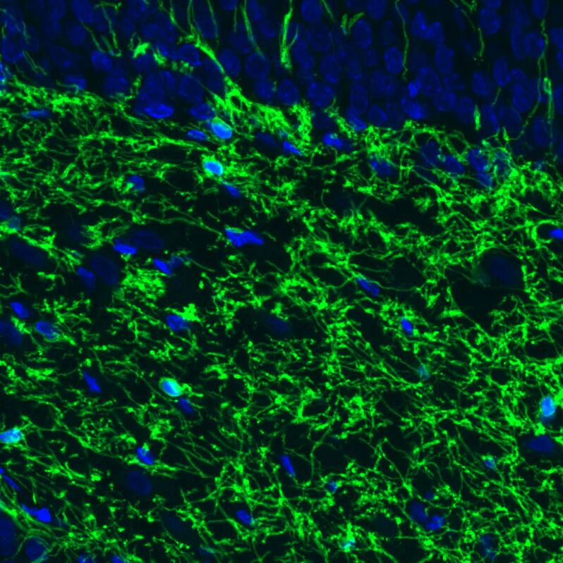 Staining of rat brain shows strong positivity in oligodendrocytes in the dentate gyrus of the hippocampus.