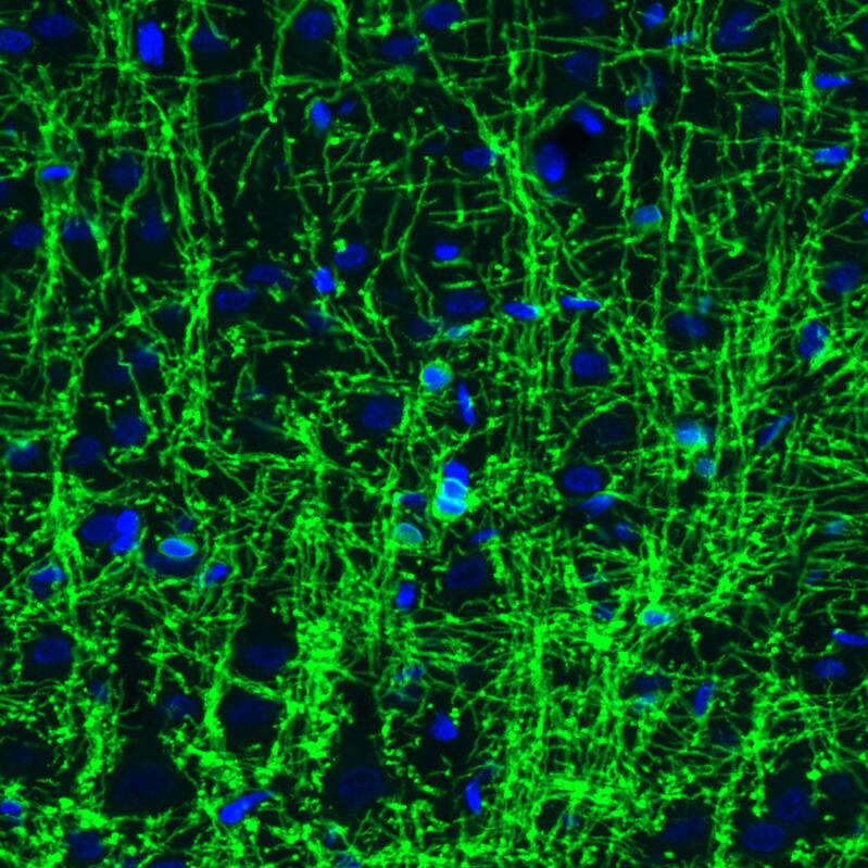 Staining of rat brain shows strong positivity in oligodendrocytes in cerebral cortex.
