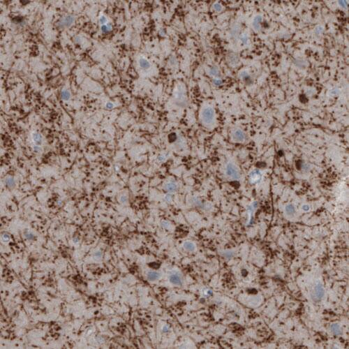 Staining of human cerebral cortex shows strong immunoreactivity in oligodendrocytes.