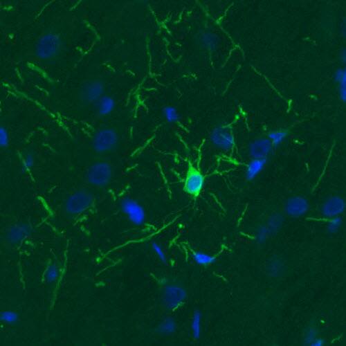 Staining of rat cerebral cortex shows strong immunoreactivity in a single oligodendrocyte.