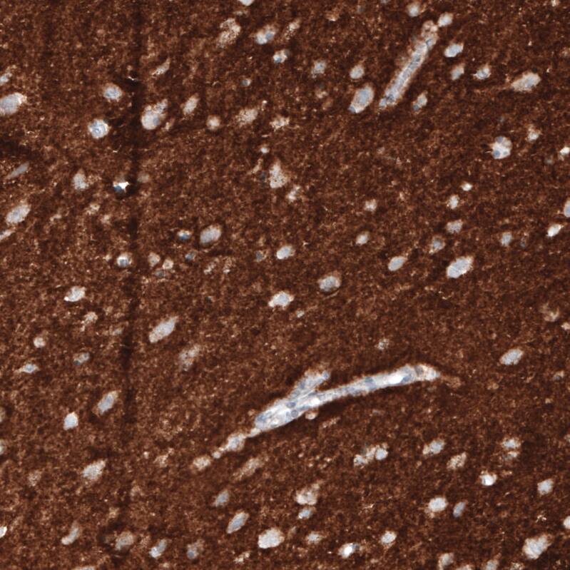Staining of human cerebral cortex shows strong positivity in neuropil.