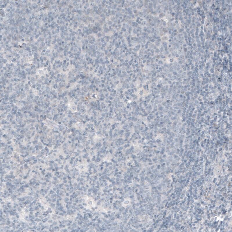 Staining of human tonsil shows no positivity in lymphoid cells as expected.