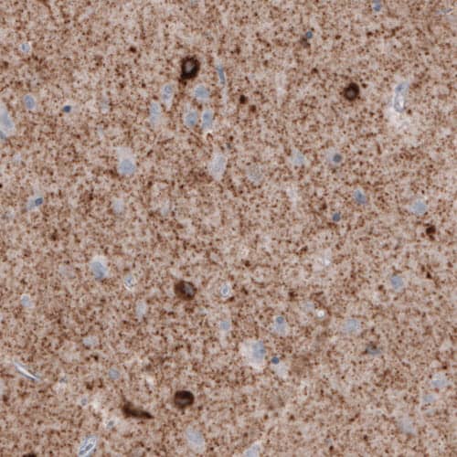 Staining of human cerebral cortex shows immunoreactivity in neuropil, as well as some neuronal cells bodies.