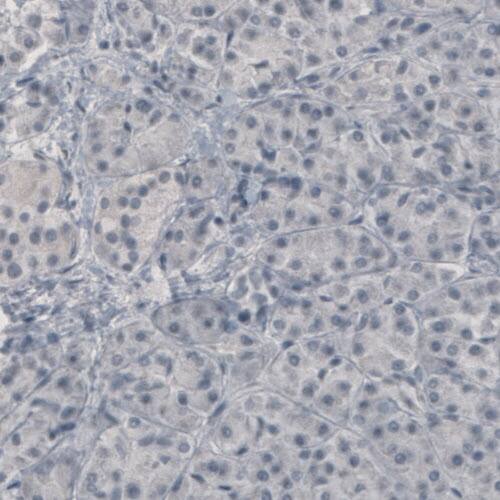Staining of human pancreas shows absence of immunoreactivity (negative control).