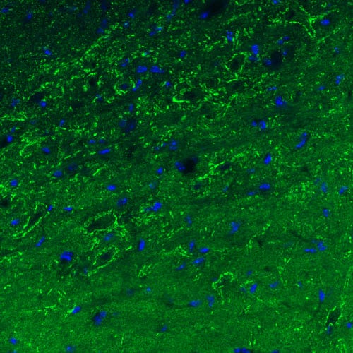 Staining of mouse substantia nigra shows strong immunoreactivity in GABAergic neural processes.