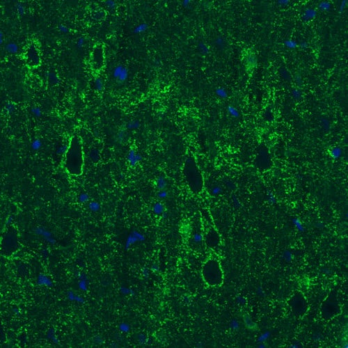 Staining of rat cerebral cortex shows strong positivity in GABAergic synapses on pyramidal neurons.