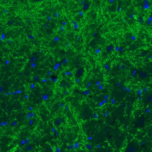 Staining of rat basal forebrain shows moderate immunoreactivity in GABAergic fibers.
