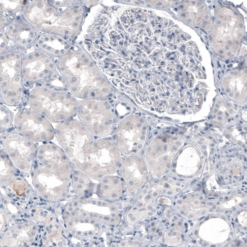Staining of human kidney shows no positivity in cells in tubules or glomeruli as expected.