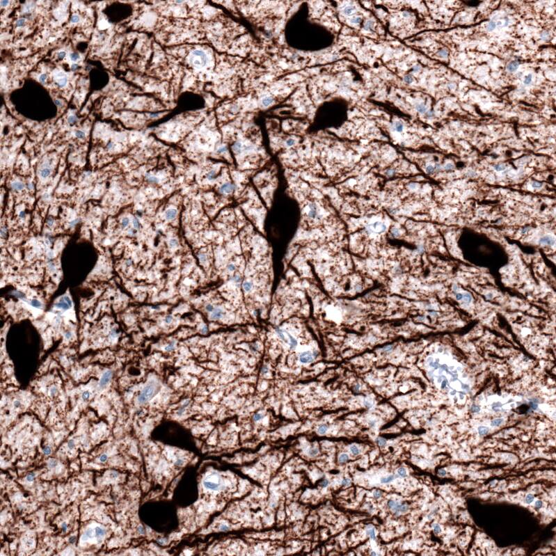 Staining of human dorsal raphe nucleus shows strong cytoplasmic positivity in serotonin neurons.