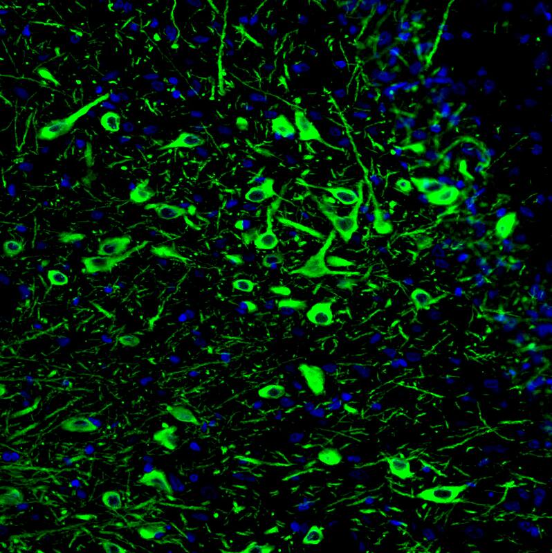 Staining of rat midbrain shows strong positivity in serotonin neurons in the dorsal raphe nucleus.