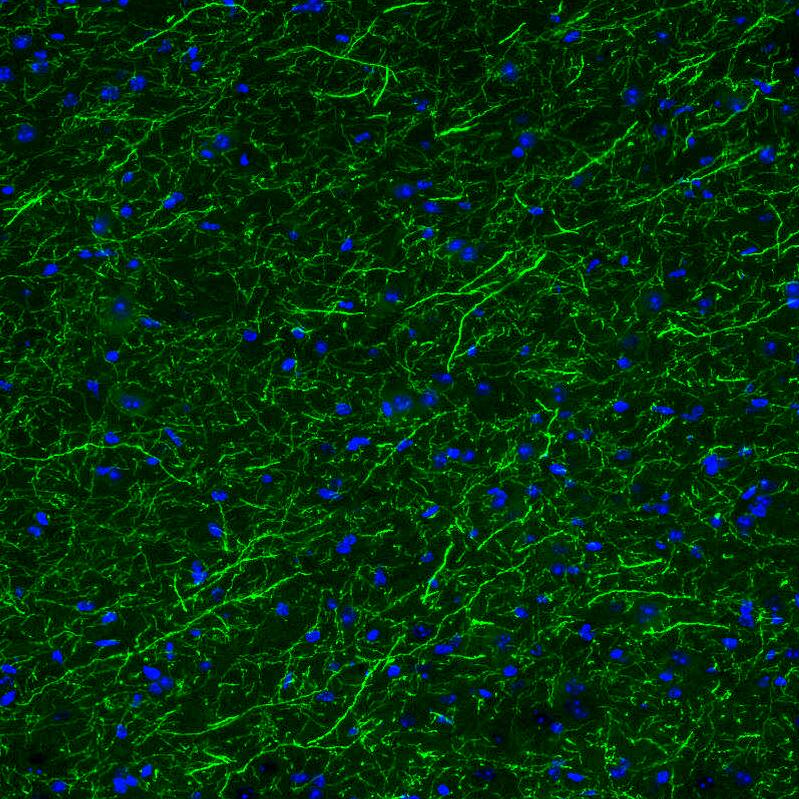 Staining of mouse brain shows moderate positivity in serotonergic fibers in the basal forebrain.