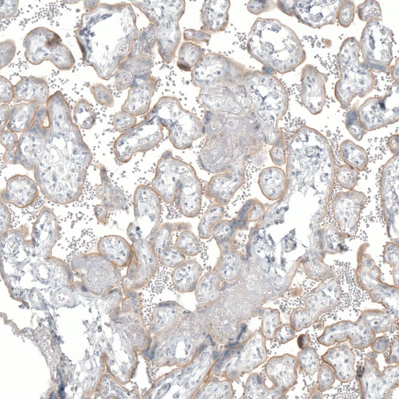 Staining of human placenta shows weak membranous positivity in trophoblastic cells.