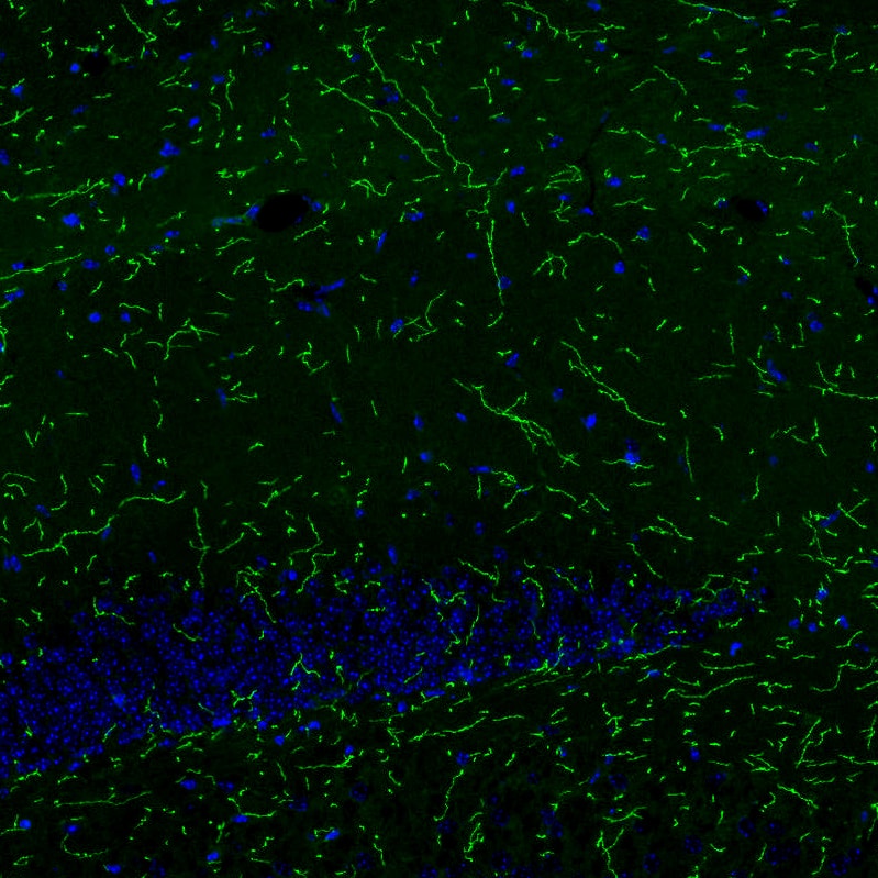 Staining of mouse brain shows strong positivity in noradrenergic fibers in the hippocampus.