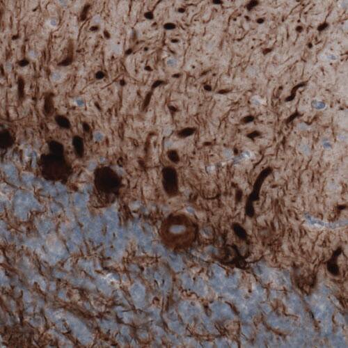 Staining of human cerebellum shows strong immunoreactivity in Purkinje cells and neural fibers.