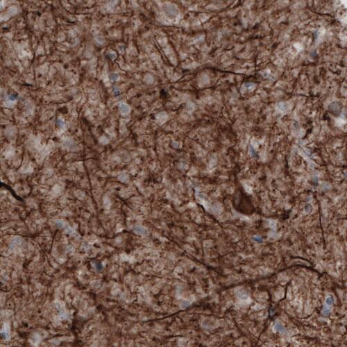Staining of human cerebral cortex shows strong positivity in neural fibers.