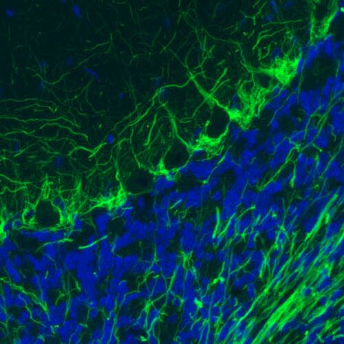 Staining of rat cerebellum shows strong immunoreactivity in neuronal processes.