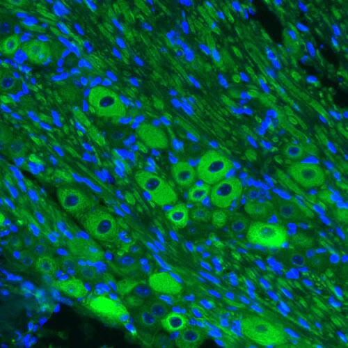 Staining of mouse trigeminal ganglion shows strong immunoreactivity in ganglion cells.