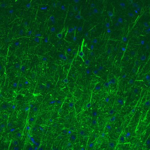 Staining of mouse cerebral cortex shows strong immunoreactivity in neurofilaments.
