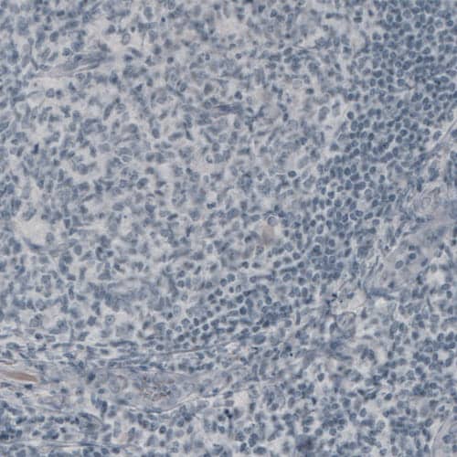 Staining of human tonsil shows absence of immunoreactivity (negative control).