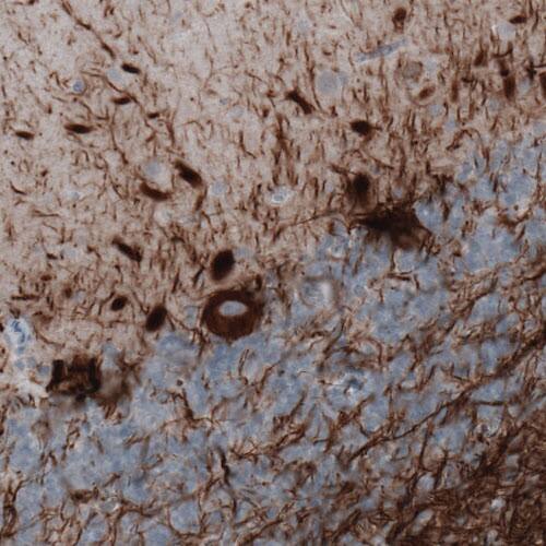 Staining of human cerebellum shows strong immunoreactivity in Purkinje cells and neural fibers.