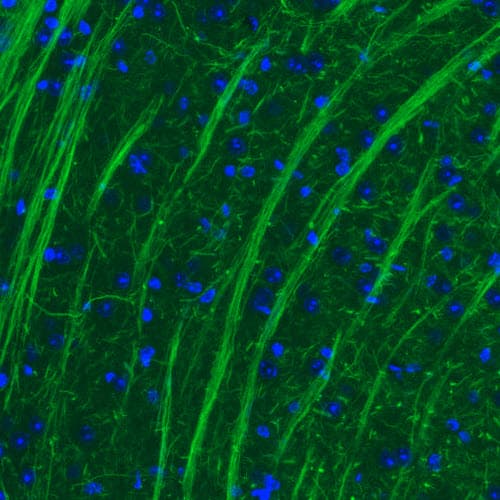 Staining of mouse thalamus shows strong positivity in neural fibers.
