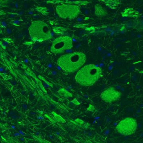 Staining of rat brainstem shows strong positivity in neurons of mesencephalic trigeminal nucleus.