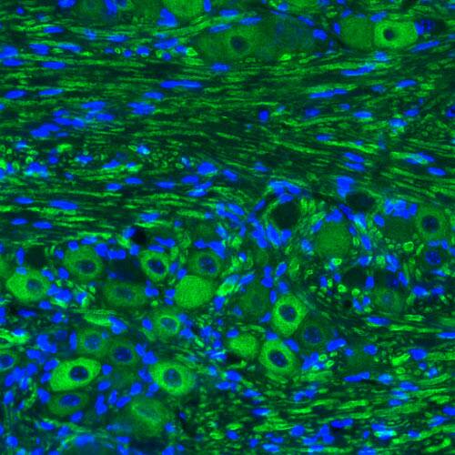 Staining of mouse trigeminal ganglion shows strong immunoreactivity in ganglion cells.