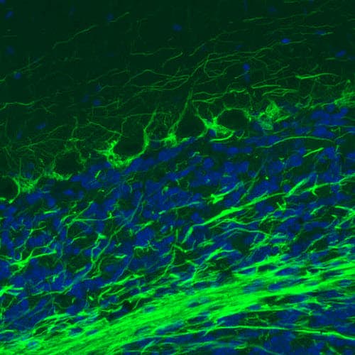 Staining of rat cerebellum shows strong immunoreactivity in neuronal processes.