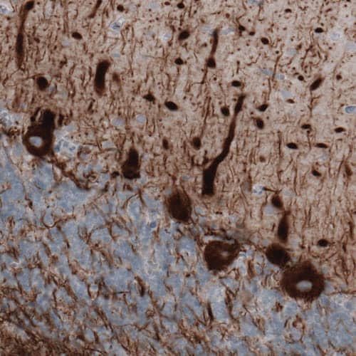 Staining of human cerebellum shows strong immunoreactivity in Purkinje cells and neuronal processes.