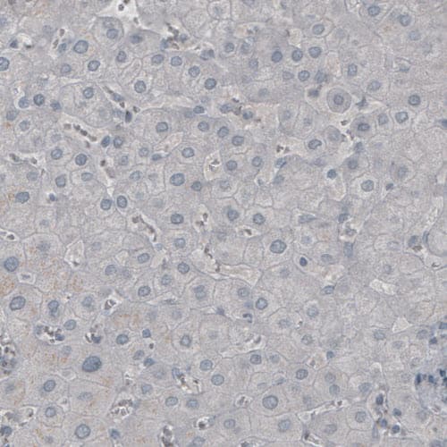 Staining of human liver shows absence of immunoreactivity (negative control).