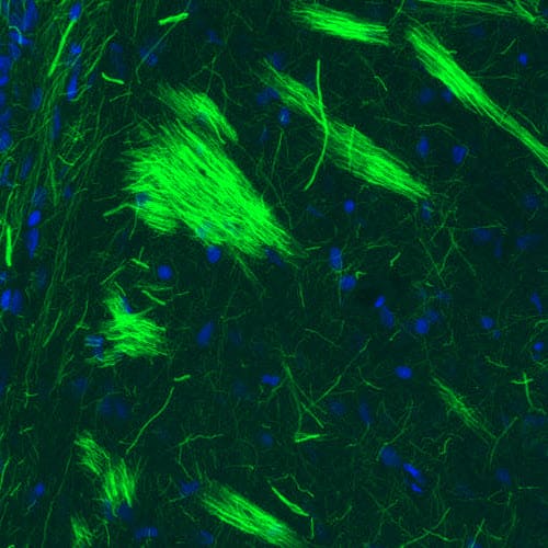 Staining of rat striatum shows strong positivity in neural fibers.