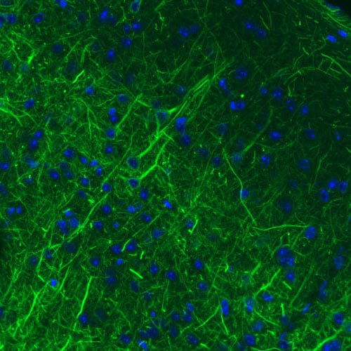 Staining of mouse cerebral cortex shows strong immunoreactivity in neuronal processes.